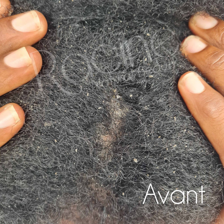 Yéna'ba | Spray Assainissant Spécial cuir chevelu (200ml) - Dreadlocks - Center