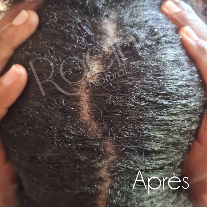 Yéna'ba | Spray Assainissant Spécial cuir chevelu (200ml) - Dreadlocks - Center
